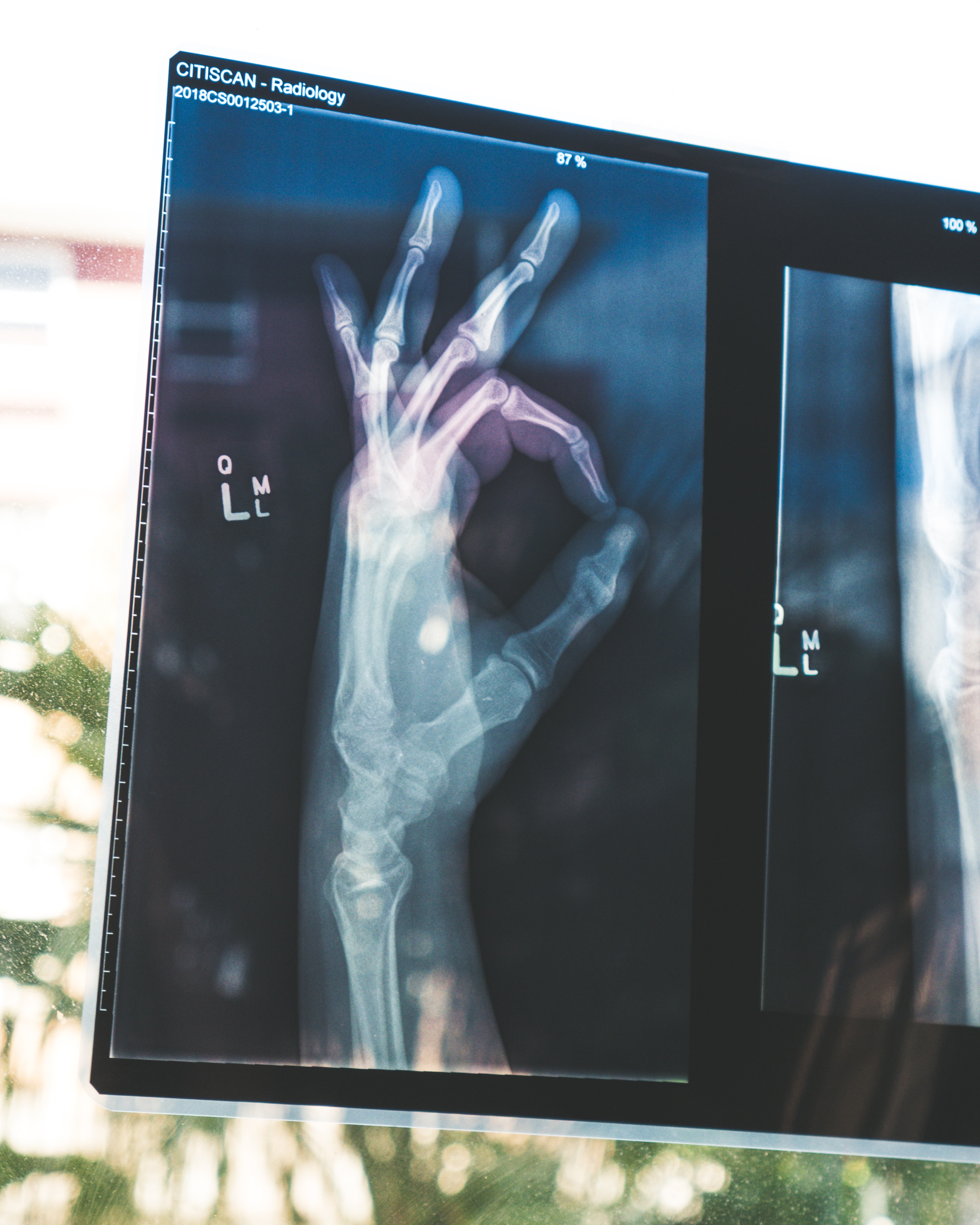improve bone density